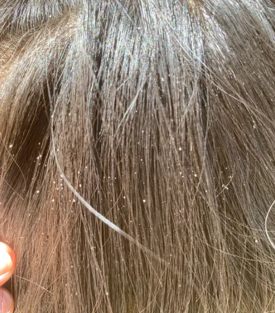 LiceDoctors Customer Service FAQs Get Answers to Your Lice Removal